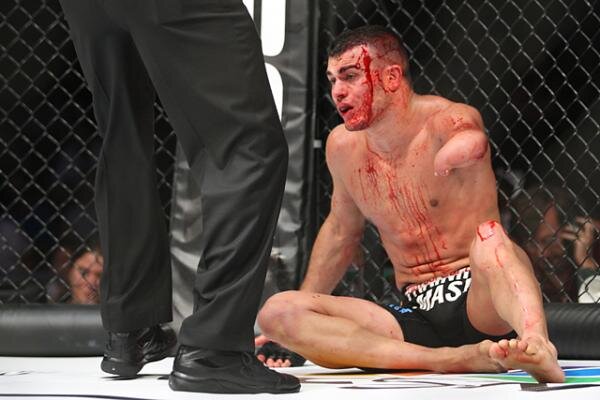 Ник Ньюэлл после боя с Джастином Гэтжи