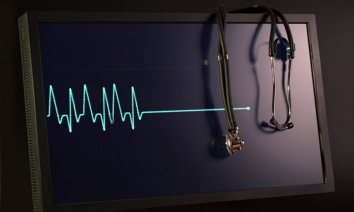 Quali me. Клиническая смерть на мониторе.