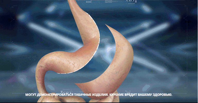  Рукавная гастропластика, билиопанкреатическое или желудочное шунтирование