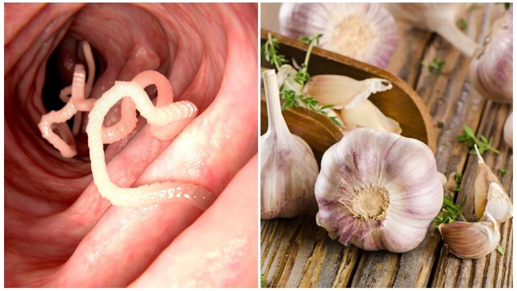 Источник фото: https://vedfarm.ru/uhod/chesnok-protiv-glistov-lechenie-ot-parazitov.html