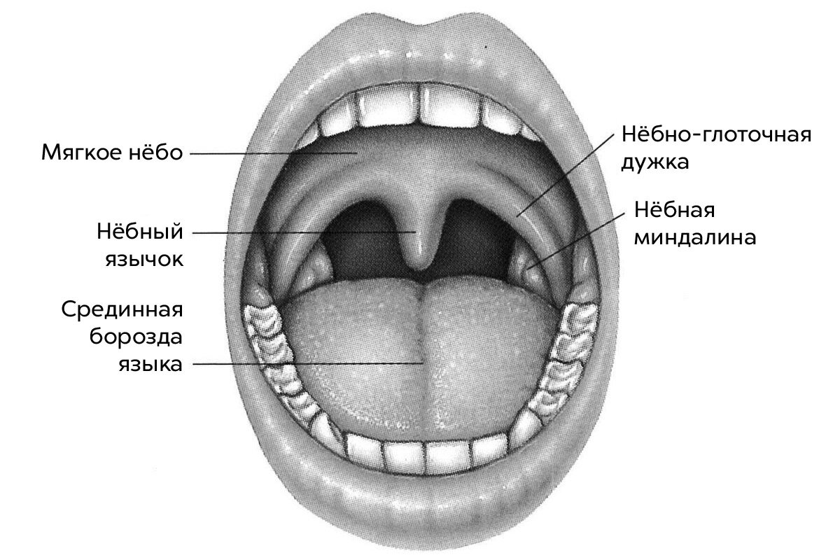 Гипертрофия небных миндалин