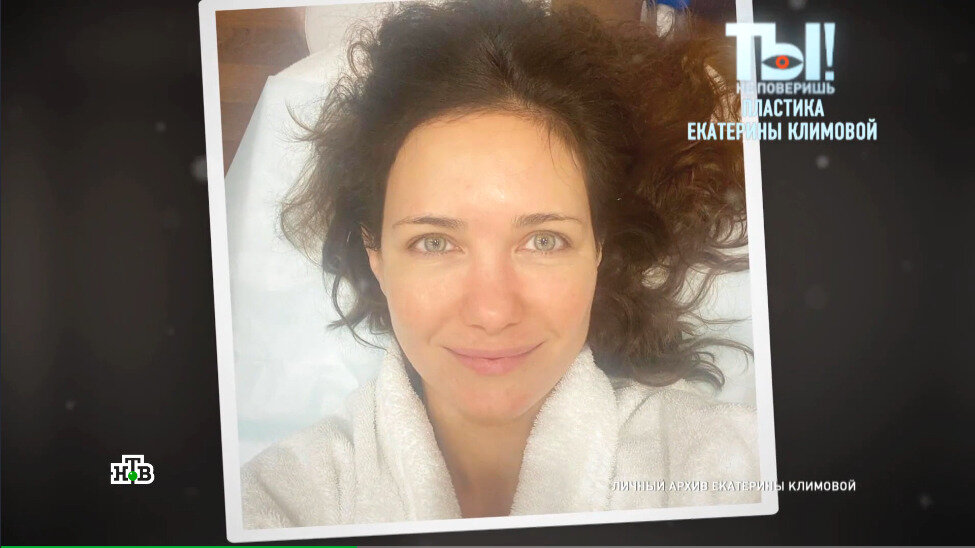    Екатерина Климова спокойно относится к пластической хирургии. Фото: кадр из передачи «Ты не поверишь»