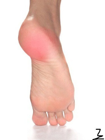  Причины получения травмы.