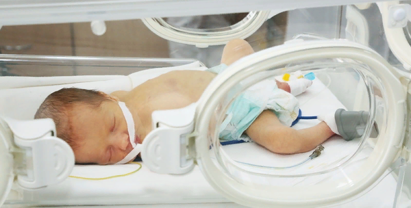 Реанимация новорожденного