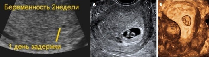 В 2 3 недели 0. Эмбрион на 4 неделе беременности.