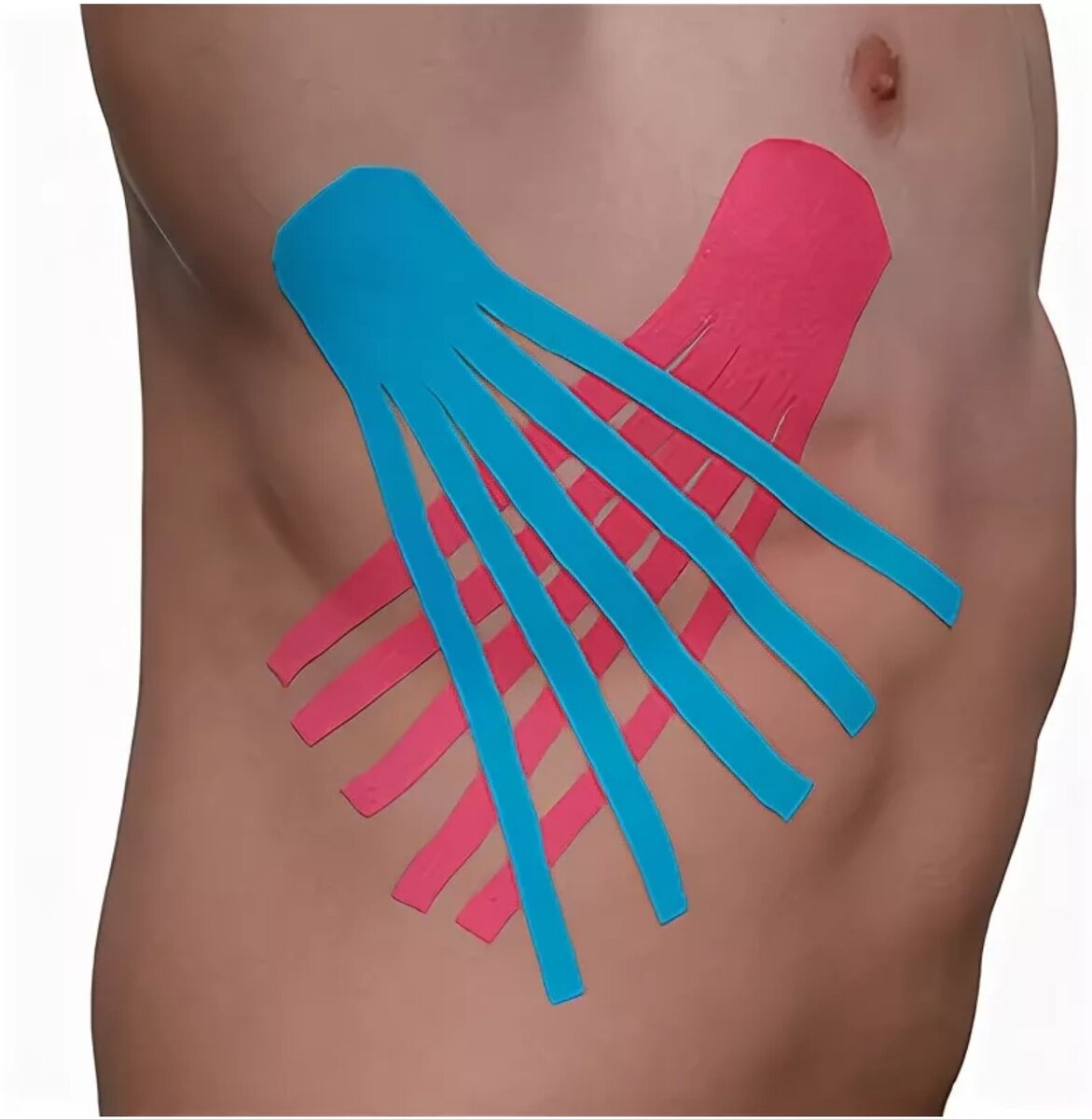 Тейпирование при межреберной невралгии. Тейп на ребро. Межреберная невралгия тейпы. Тейп на ключицу. Тейпы при межреберной невралгии.