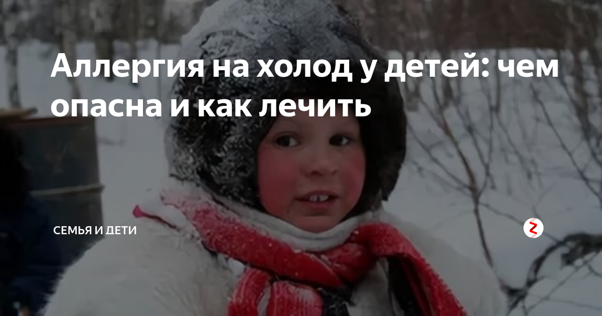 Аллергия на холод симптомы фото У ребенка аллергия на холод фото - ViktoriaFoto.ru