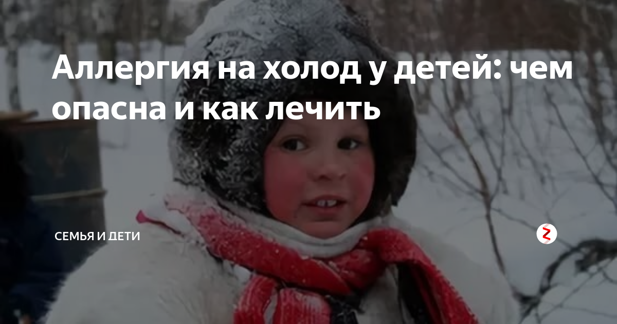 U cold. Аллергия на холод у ребенка. Реакция на Мороз у ребенка.