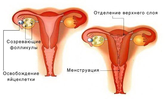 Обильные месячные или гиперменорея | Что делать при обильной менструации со сгустками?