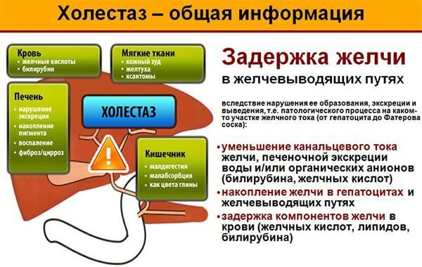 Застой желчи - причина, симптомы и методы профилактики