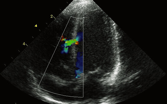 УЗИ показывает многое во время беременности 