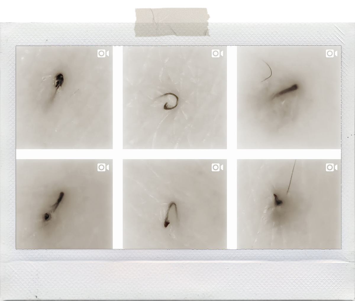 Мне не нужно рассказывать вам, насколько раздражающими и болезненными могут быть вросшие волосы. Если у вас когда-либо был хотя бы один, вы это знаете не понаслышке. 