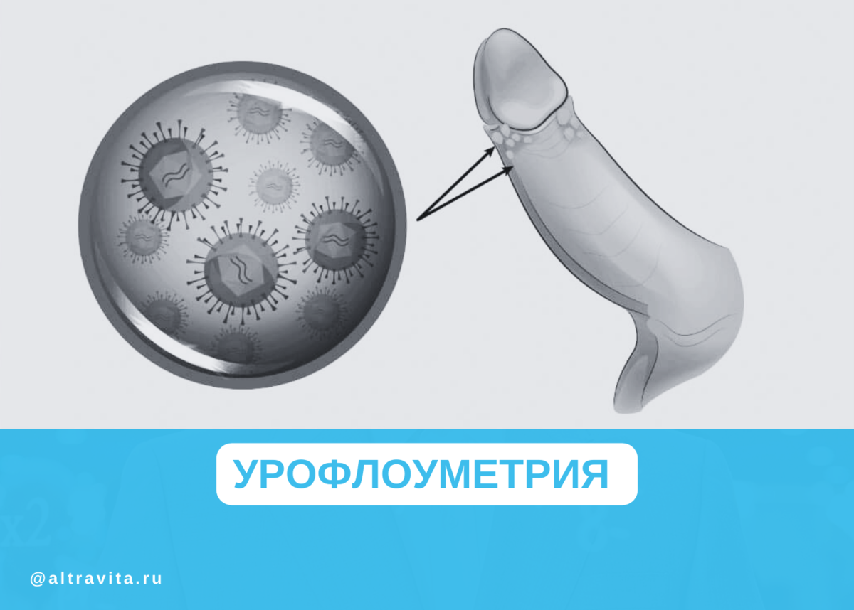 Урофлоуметрия