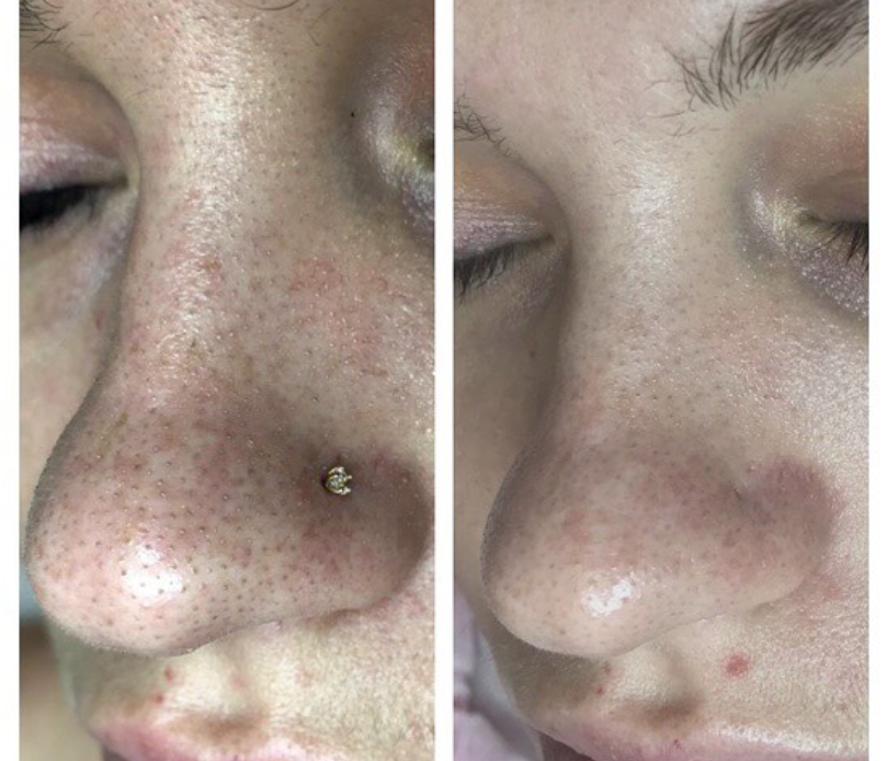 Результат после чистки