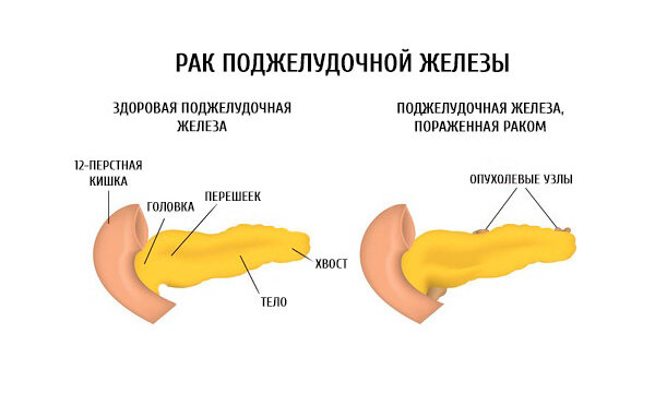 Что самое главное в отношениях?