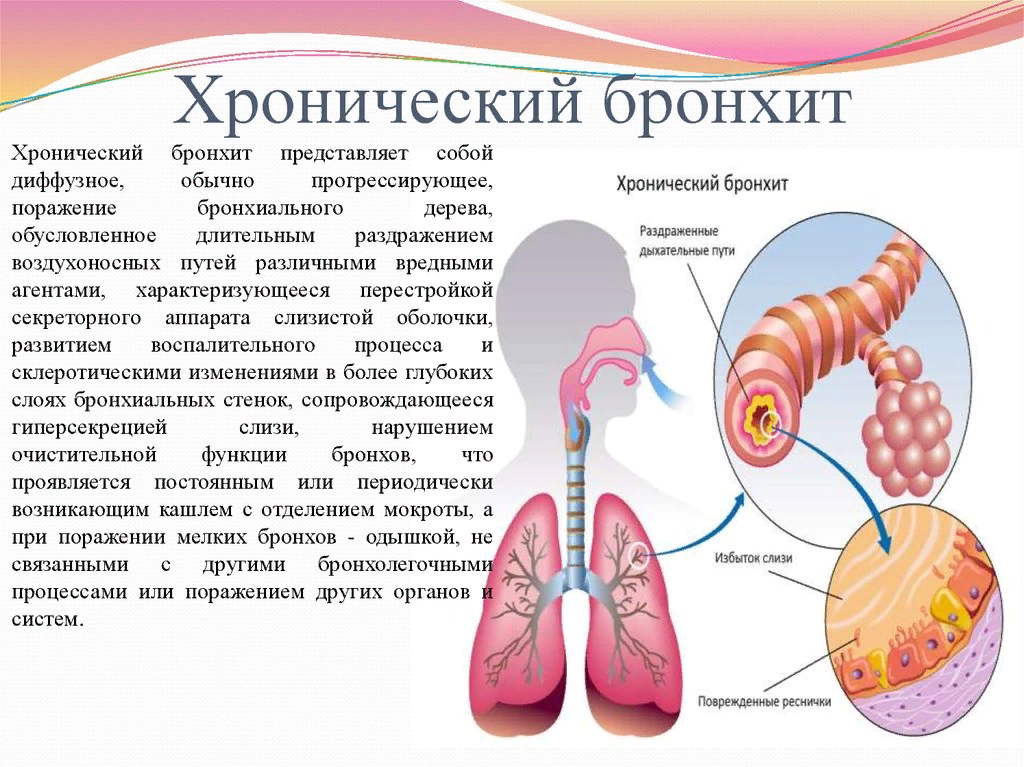 Поразить представить. Бронхит это хроническое заболевание. Заболевания органов дыхания хронический бронхит. Хроническое воспаление бронхов. Бронхи при хроническом бронхите.