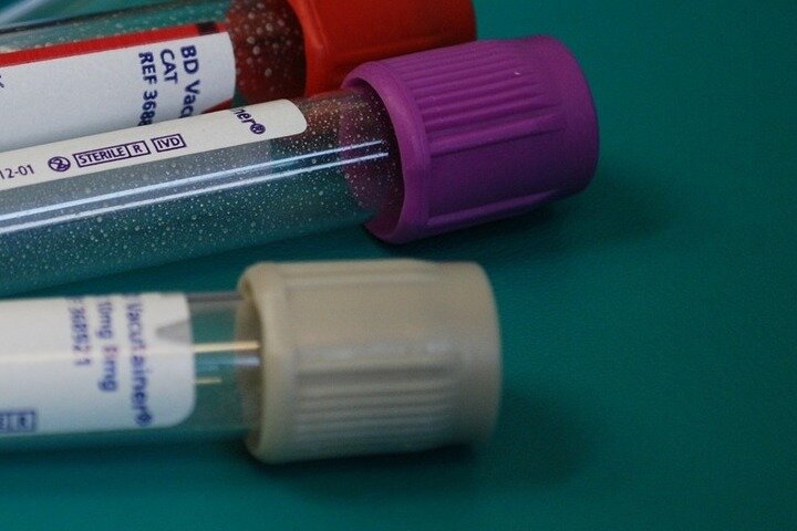 Фото: pixabay.com