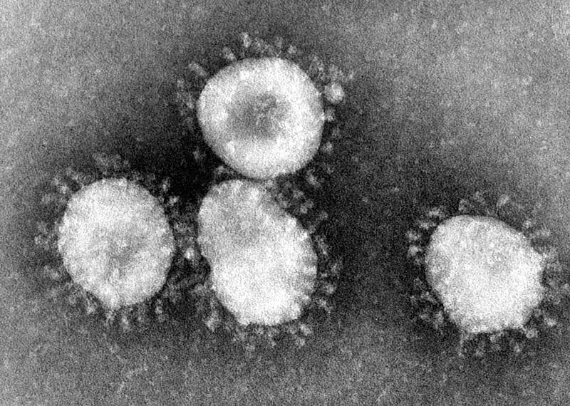 Коронавирусы под микроскопом. Фото: https://commons.wikimedia.org/wiki/File:Coronaviruses_004_lores.jpg?uselang=ru