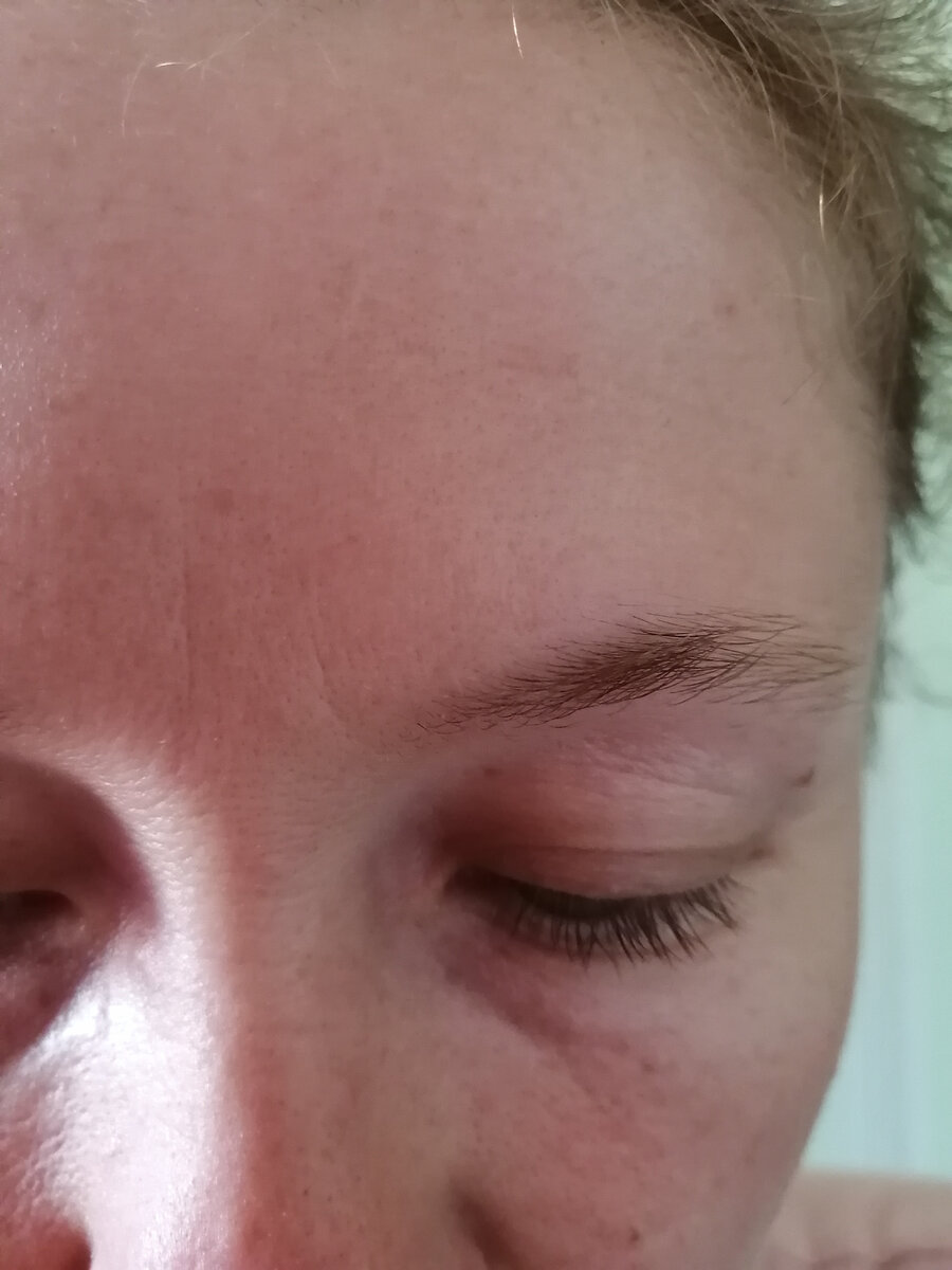 возрастные изменения