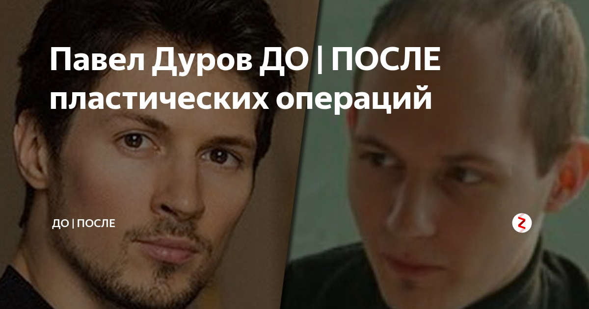 Дуров до и после пластики. Павел Дуров и Киану Ривз. Павел Дуров пластические операции. Павел Дуров после пластики. Дуров Павел до и после операции.