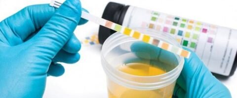  Для уточнения диагноза проводится развернутый суточный тест