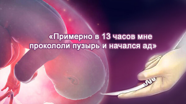 Из реальной истории, рассказанной анонимно в паблике #насилие_в_родах