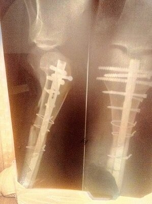 А это результат травмы