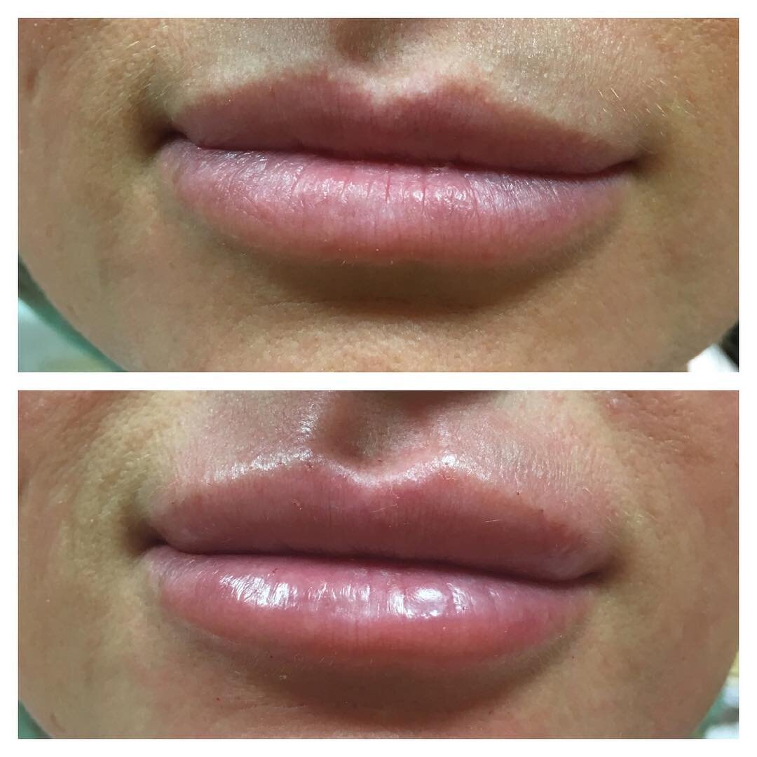 источник:https://www.instagram.com/dr.pustokhina_irina/
