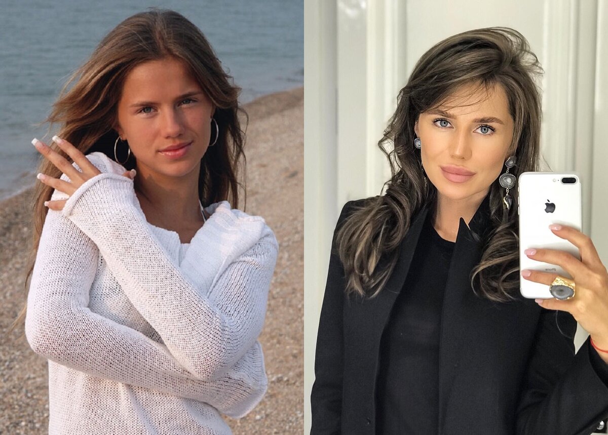 алекса певица до и после пластики. алекса певица до пластики. алекса фабрика звезд до и после пластики. алекса певица в молодости до пластики. алекса фабрика звезд.