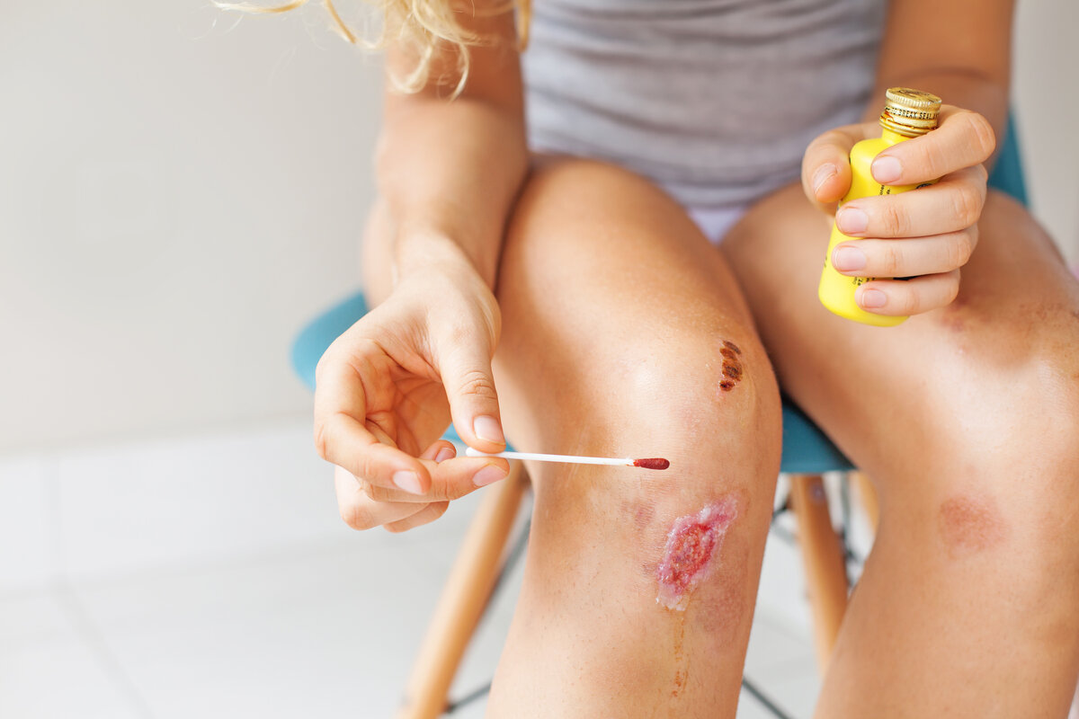 Используем препараты, ускоряющие заживление