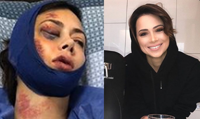 Сама звезда в 2018 году тоже подвергалась "жестокому избиению", но это оказалось обычной инсценировкой :)