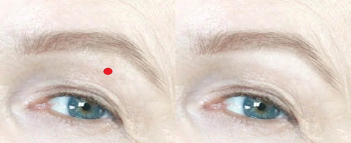 Кстати, высветлять эту область лучше косметикой с легким подсвечивающим финишем, но не хайлайтером