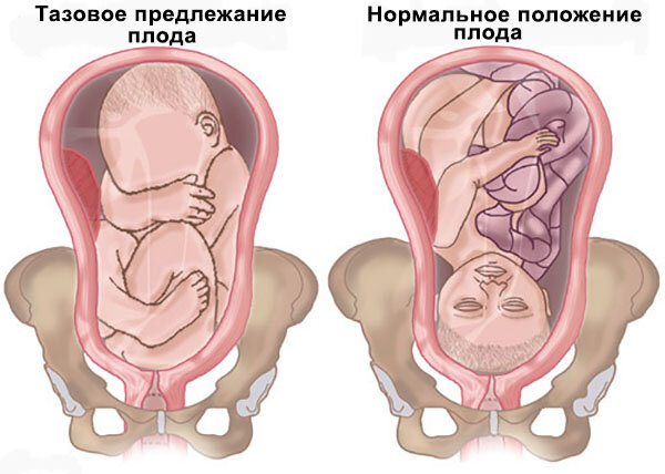 Половая жизнь во время беременности