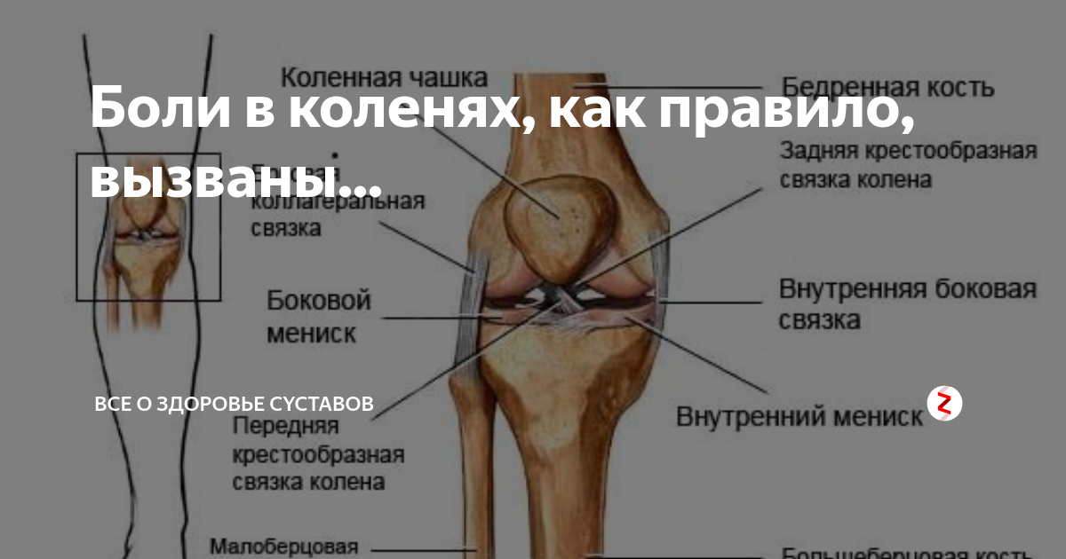 Рак коленного сустава