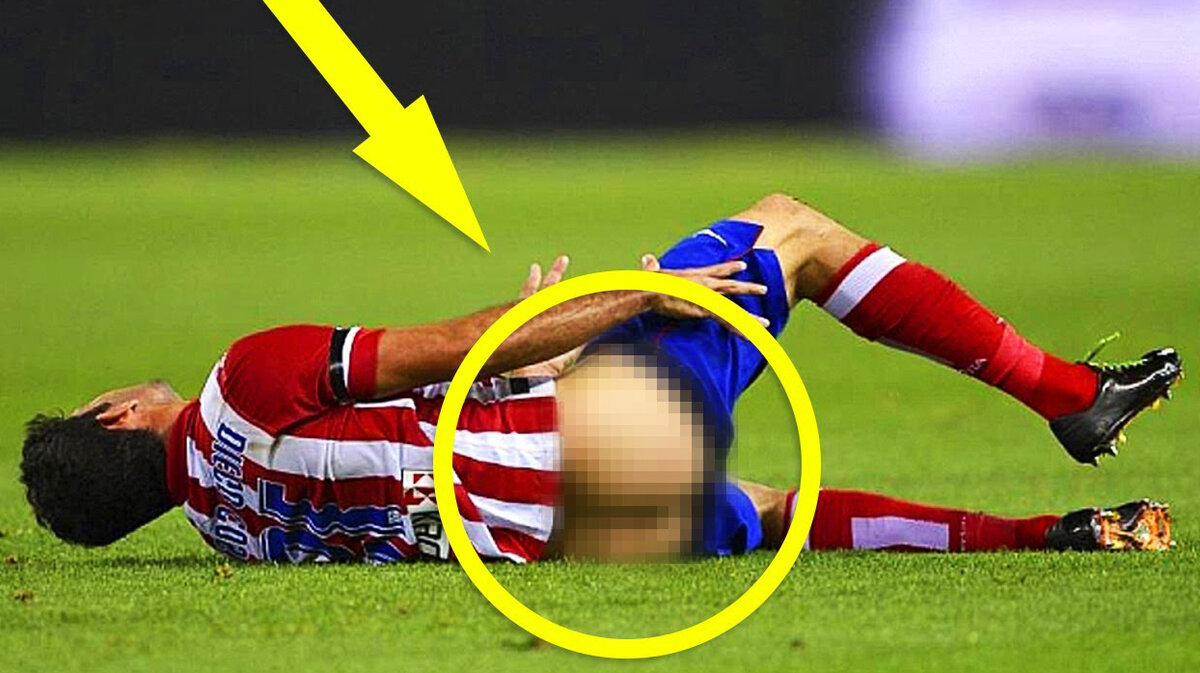 Во время футбола мало кто обращает внимание на нелепые ситуации, которые случаются с игроками, но после матчей фотографии разлетаются по всей сети интернет.
