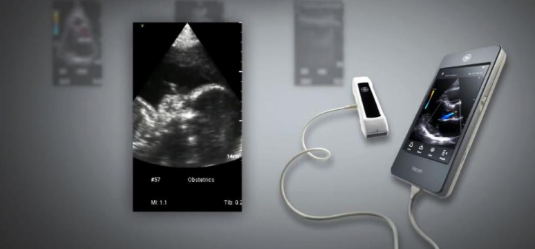 УЗИ с искусственным интеллектом