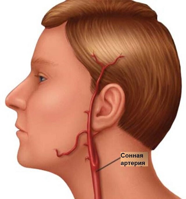 где находится сонная артерия у человека фото