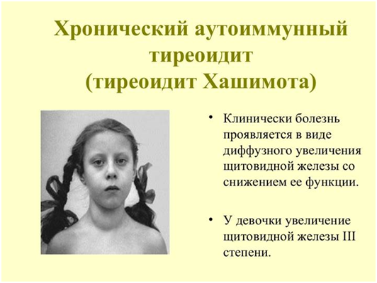  Фотография взята из источника present5.com