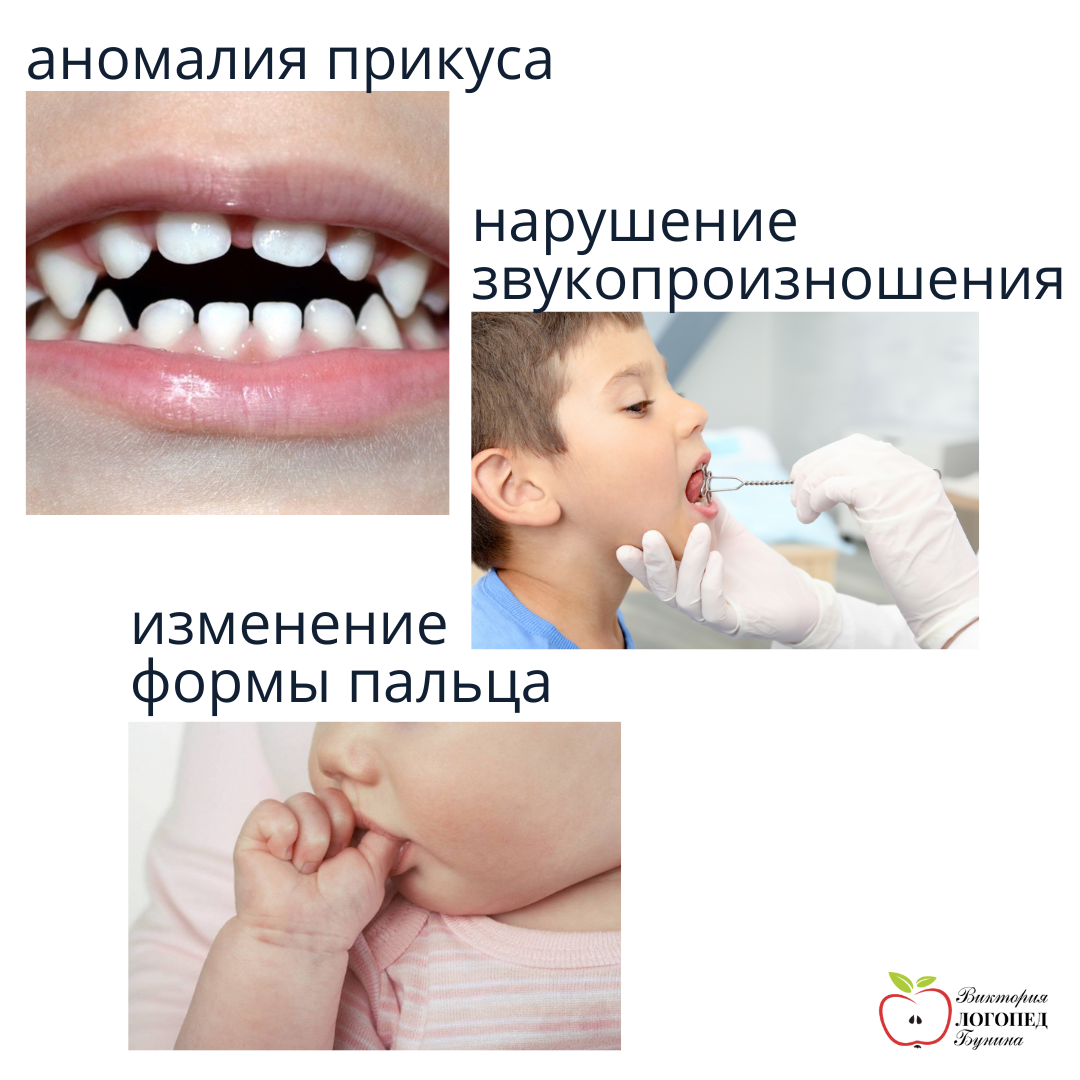 Причины почему ребенок сосет палец | Colgate®