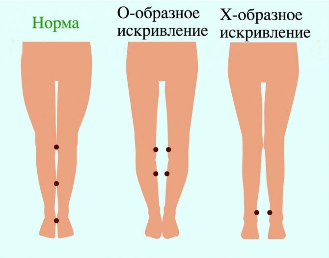 Когда простота хуже чего угодно: nadportem - ЖЖ