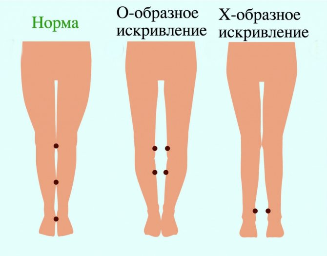 Худые ноги у девушки. Фото, что делать, что носить, упражнения на неделю, как ис