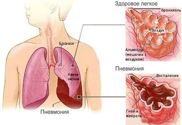 Похожие статьи