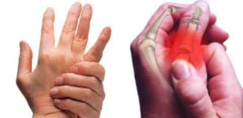  Фото: причины повреждения целостности пальцев