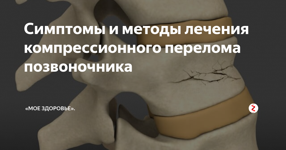 Перелом позвоночника у пожилых людей лечение. Компрессионный перелом позвоночника поясничного отдела лечение. Препараты при компрессионном переломе позвоночника. Старческий перелом позвоночника. Компрессионный перелом позвоночника у пожилых людей
