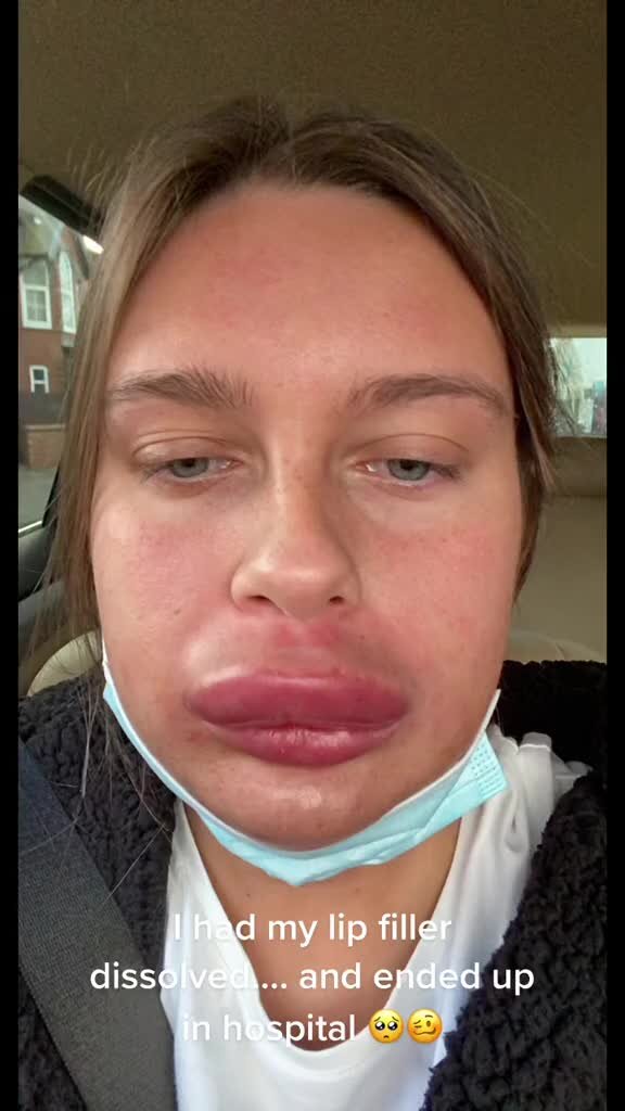    Видео: Тикток @rubyyfrais