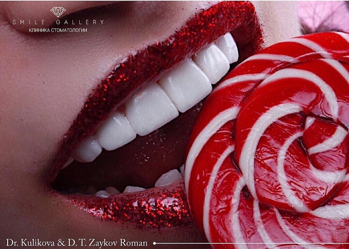 Виниры, люминиры, композитные виниры, коронка, вкладка - это всё разновидности конструкций