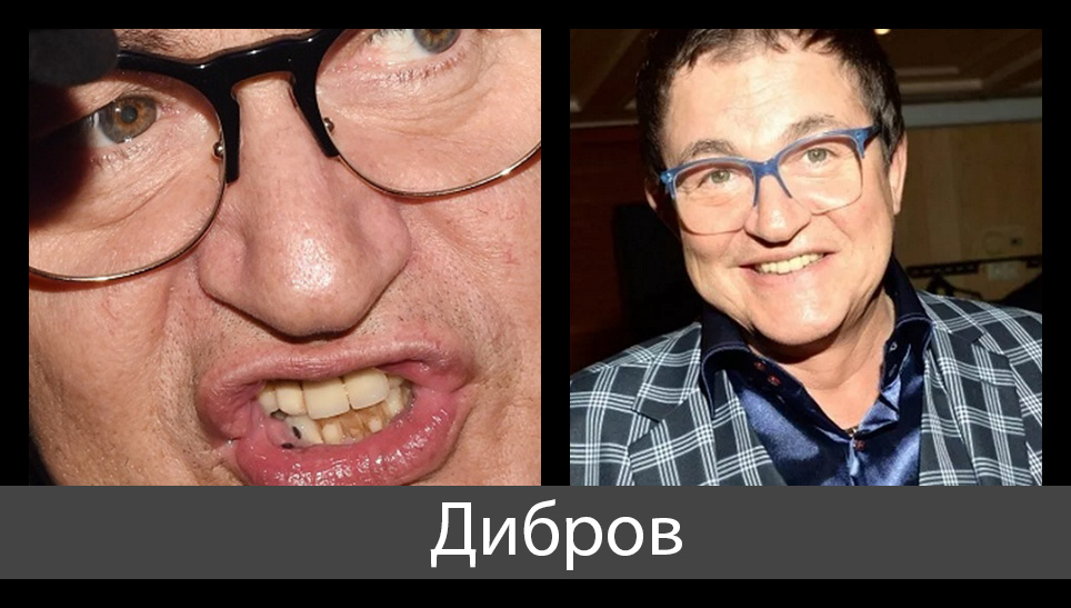 Дмитрий Дибров. Коллаж из фото открытых источников.