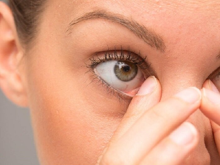 Фото Человек потёр глаза.