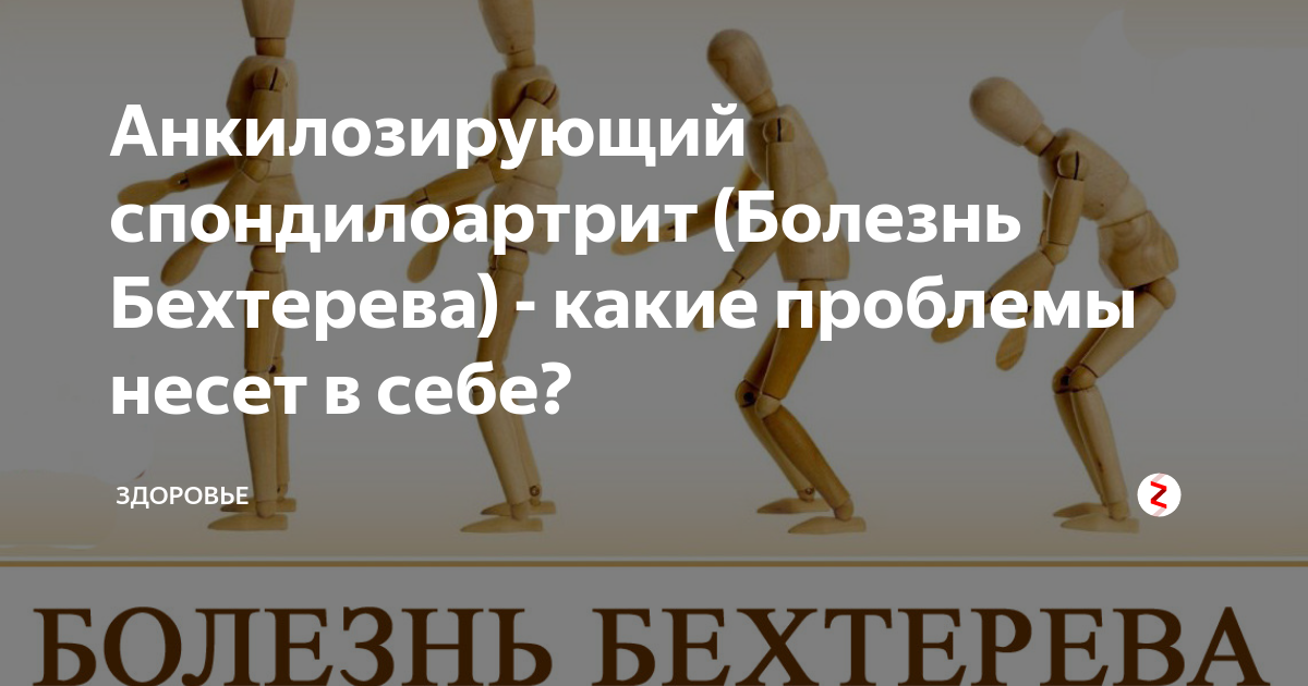 Что делать при болезни бехтерева. Анкилозирующий спондилоартрит. Анкилозирующий спондилоартрит физические упражнения. Цигун болезнь Бехтерева аутоиммунные заболевания.