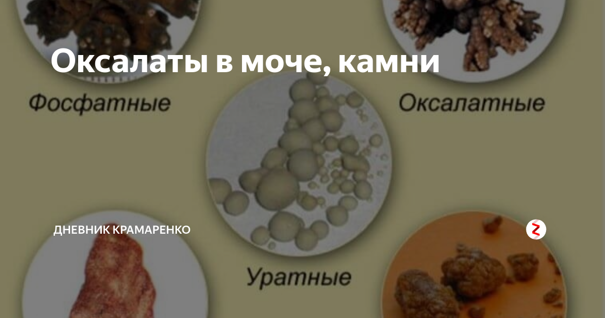 Камни в мочевом пузыре у кошки: найдено 86 изображений